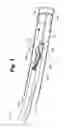 Fig. 04 - Multiple transducer delivery device and method