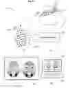 Fig. 10 - Systems, methods, and devices for assessing microbiota of skin