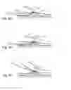 Fig. 06 - METHOD FOR EXCISING CORE TISSUE SAMPLE
