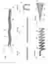 Fig. 02 - Micrograft for the treatment of intracranial aneurysms and method for use