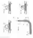 Fig. 09 - Micrograft for the treatment of intracranial aneurysms and method for use