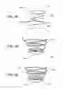 Fig. 05 - Systems for sealing a tissue wall puncture
