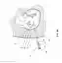 Fig. 22 - Tissue engagement devices, systems, and methods