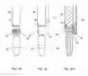 Fig. 10 - Devices and systems for surgical retraction