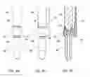 Fig. 11 - Devices and systems for surgical retraction