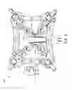 Fig. 04 - RETRACTOR DEVICES FOR MINIMALLY INVASIVE ACCESS TO THE SPINE