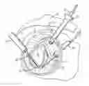 Fig. 01 - METHODS AND APPARATUS FOR PERFORMING ARTHROSCOPIC SURGERY