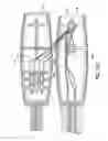 Fig. 15 - Suture anchor management