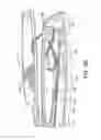 Fig. 16 - Suture anchor management
