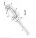 Fig. 20 - Suture anchor management