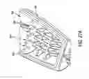 Fig. 27 - Suture anchor management