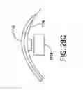 Fig. 31 - Suture anchor management