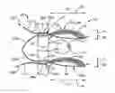 Fig. 01 - Methods for approximating a tissue defect using an anchor assembly