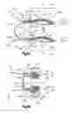 Fig. 02 - Methods for approximating a tissue defect using an anchor assembly