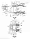 Fig. 03 - Methods for approximating a tissue defect using an anchor assembly