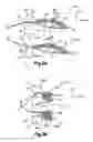 Fig. 06 - Methods for approximating a tissue defect using an anchor assembly