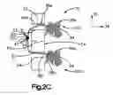 Fig. 07 - Methods for approximating a tissue defect using an anchor assembly