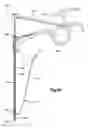 Fig. 08 - Methods for approximating a tissue defect using an anchor assembly