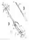 Fig. 16 - Methods for approximating a tissue defect using an anchor assembly