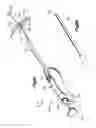 Fig. 18 - Methods for approximating a tissue defect using an anchor assembly