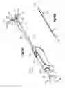 Fig. 21 - Methods for approximating a tissue defect using an anchor assembly