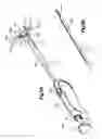 Fig. 23 - Methods for approximating a tissue defect using an anchor assembly