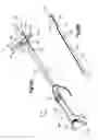 Fig. 25 - Methods for approximating a tissue defect using an anchor assembly