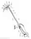 Fig. 27 - Methods for approximating a tissue defect using an anchor assembly