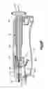 Fig. 28 - Methods for approximating a tissue defect using an anchor assembly