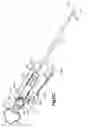 Fig. 31 - Methods for approximating a tissue defect using an anchor assembly