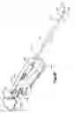 Fig. 33 - Methods for approximating a tissue defect using an anchor assembly