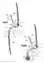 Fig. 40 - Methods for approximating a tissue defect using an anchor assembly