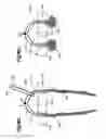 Fig. 41 - Methods for approximating a tissue defect using an anchor assembly