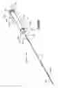 Fig. 60 - Methods for approximating a tissue defect using an anchor assembly