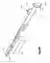 Fig. 68 - Methods for approximating a tissue defect using an anchor assembly