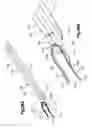 Fig. 71 - Methods for approximating a tissue defect using an anchor assembly