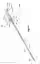 Fig. 74 - Methods for approximating a tissue defect using an anchor assembly