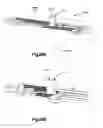 Fig. 76 - Methods for approximating a tissue defect using an anchor assembly