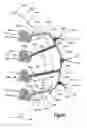 Fig. 87 - Methods for approximating a tissue defect using an anchor assembly