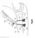 Fig. 89 - Methods for approximating a tissue defect using an anchor assembly