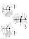 Fig. 93 - Methods for approximating a tissue defect using an anchor assembly