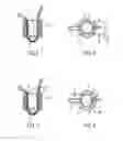 Fig. 03 - Self-cinching suture anchors, systems, and methods