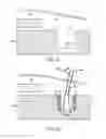Fig. 08 - Self-cinching suture anchors, systems, and methods