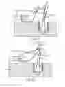 Fig. 09 - Self-cinching suture anchors, systems, and methods