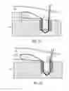 Fig. 11 - Self-cinching suture anchors, systems, and methods