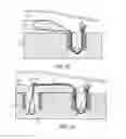 Fig. 12 - Self-cinching suture anchors, systems, and methods