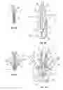Fig. 07 - Mitral valve fixation device removal devices and methods