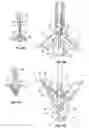 Fig. 08 - Mitral valve fixation device removal devices and methods