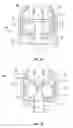 Fig. 12 - Mitral valve fixation device removal devices and methods