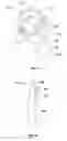 Fig. 23 - Mitral valve fixation device removal devices and methods